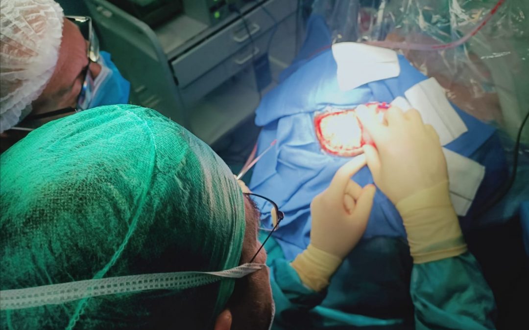 El Hospital de Jaén acoge la primera operación craneal en paciente despierta